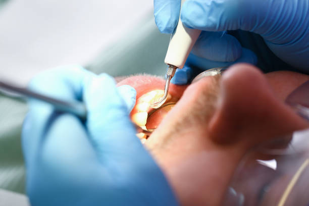 Best Orthodontic Emergency Dentist in Trail Creek, IN